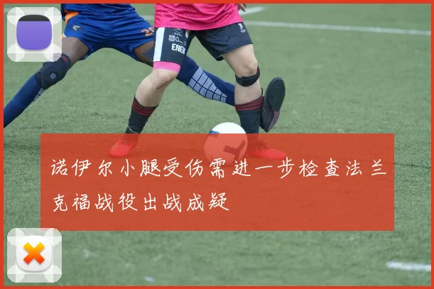 诺伊尔小腿受伤需进一步检查法兰克福战役出战成疑